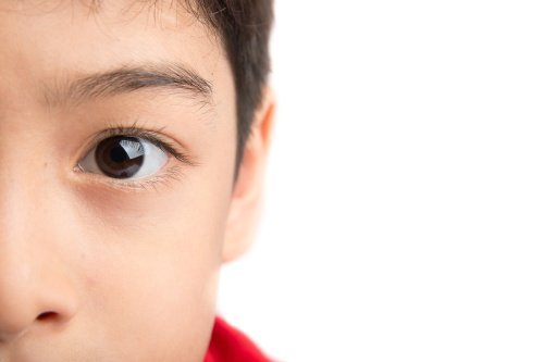 child’s prosthetic eye replacement